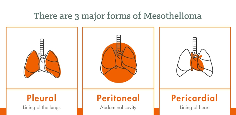 3 major forms of mesothelioma