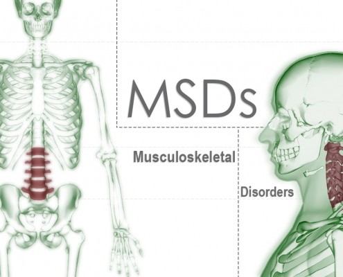 MSD Musculoskeletal Disorders