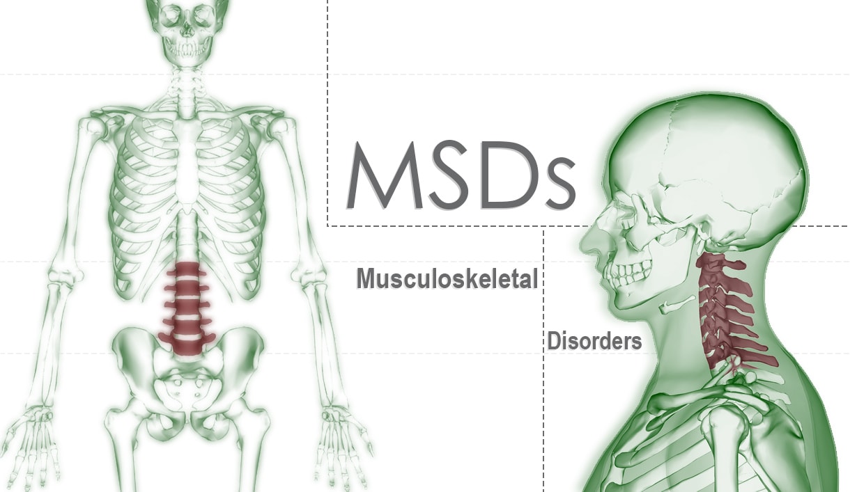 MSD Musculoskeletal Disorders