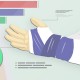 Corporate Injury Blog Image