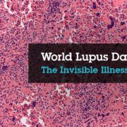 World Lupus Day - SHEilds Health and Safety