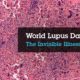 World Lupus Day - SHEilds Health and Safety