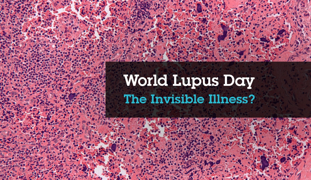 World Lupus Day - SHEilds Health and Safety