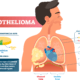 Mesothelioma Infographic
